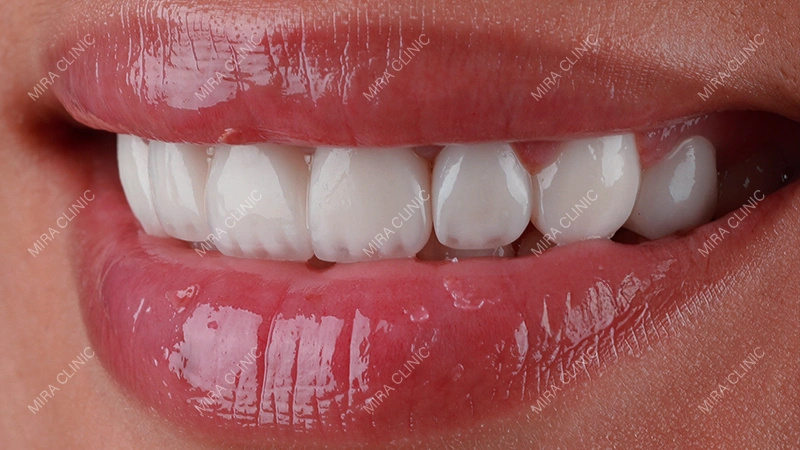 Oral Health